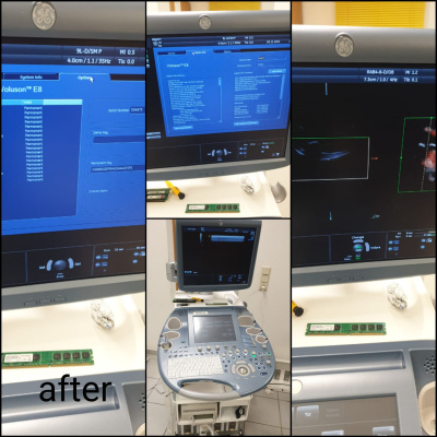 GE VOLUSON E8 ONARIMI